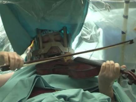 A cântat la vioară în timp ce era operată pe creier (VIDEO)